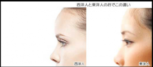 おでこプレート効果